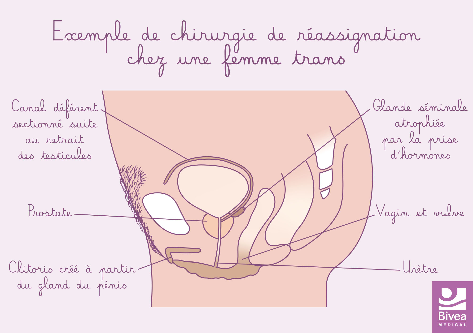 transidentité